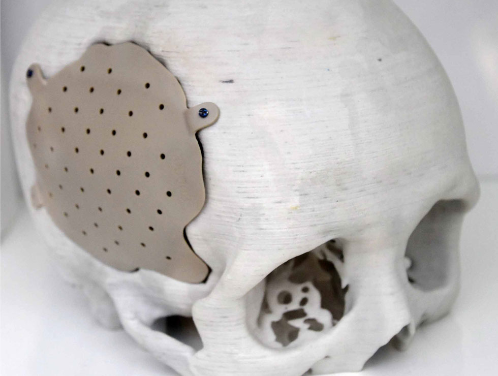 �@������ɫ�ĸ�ˎ��������Ŀ��������3D��ӡ���XĤ��